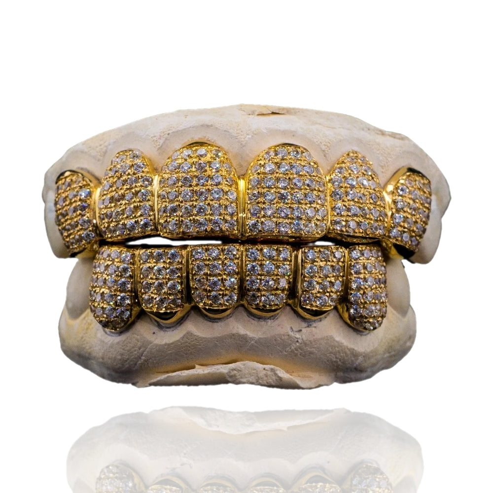VS Diamond Straight Set - 10K Gold