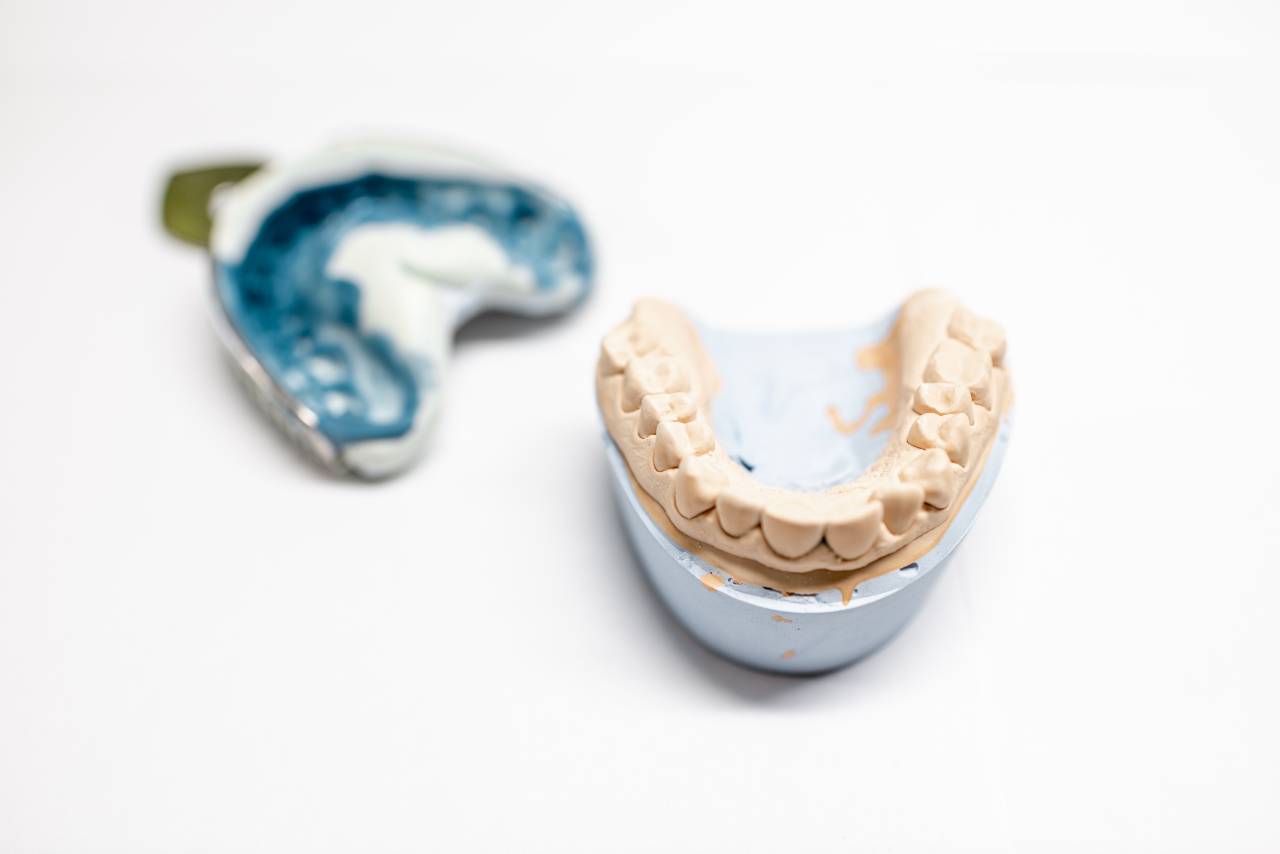 How Long Does Custom Grillz Take?